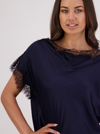 Briarwood Tabby Top