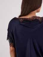 Briarwood Tabby Top